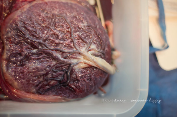 close up of a placenta