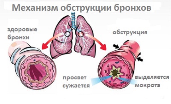 ОРВИ у ребенка: как не надо лечить